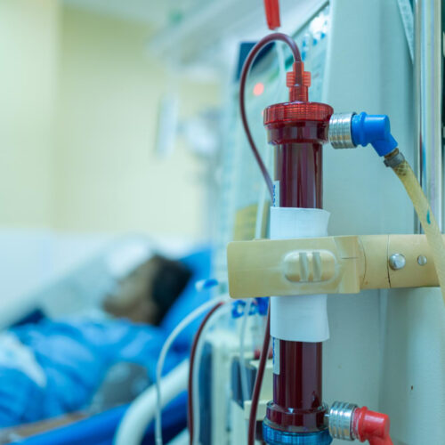 Dialysis treatment for patient